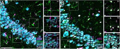 Evaluating the efficacy of purchased antisense oligonucleotides to reduce mouse and human tau in vivo